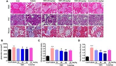 Nephroprotective Effects of Tetramethylpyrazine Nitrone TBN in Diabetic Kidney Disease